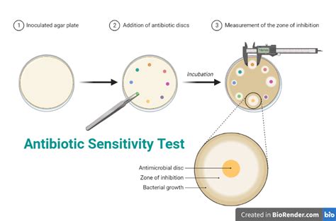 antimicrobial testing lab philippines|Microbiology and Validation .